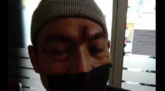 Sembako Membawa Petaka, Seorang Ketua RW di Tangsel Aniaya Warganya Cahyani. (Foto/okezone)